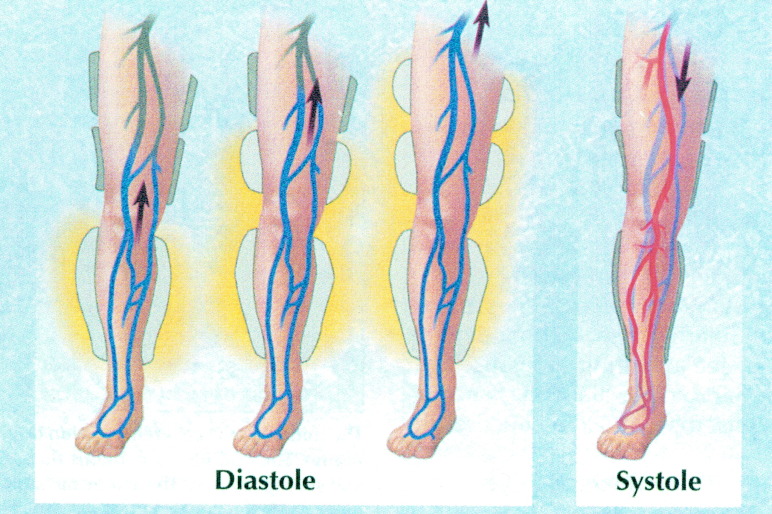 EECP Treatment Preparations